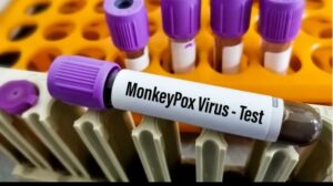 Monkeypox Alert In Uttarakhand