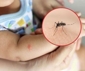Chikungunya Cases Increasing 