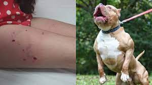 Pitbul Dog Attack Child 